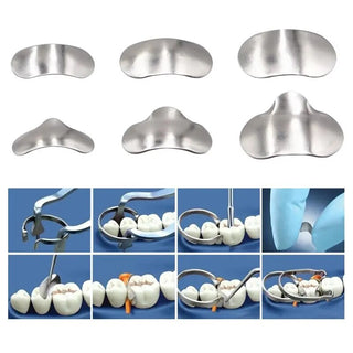 100pcs Dental Set of Matrix Sectional Contoured Metal Matrices + 2 Rings